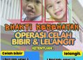 Sambut Hari Bhayangkara ke-80, Polda Jateng Gelar Operasi Gratis Celah Bibir dan Lelangit di RS Bhayangkara Semarang